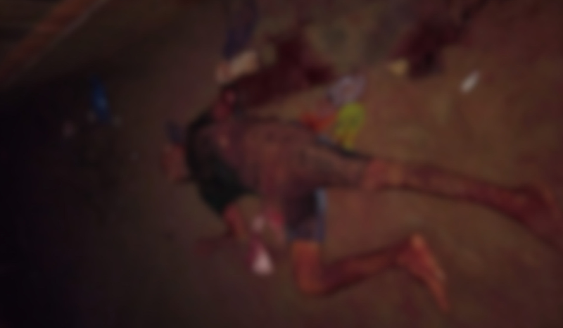 Homem morre após ter braço decepado em ataque na zona rural de Parintins