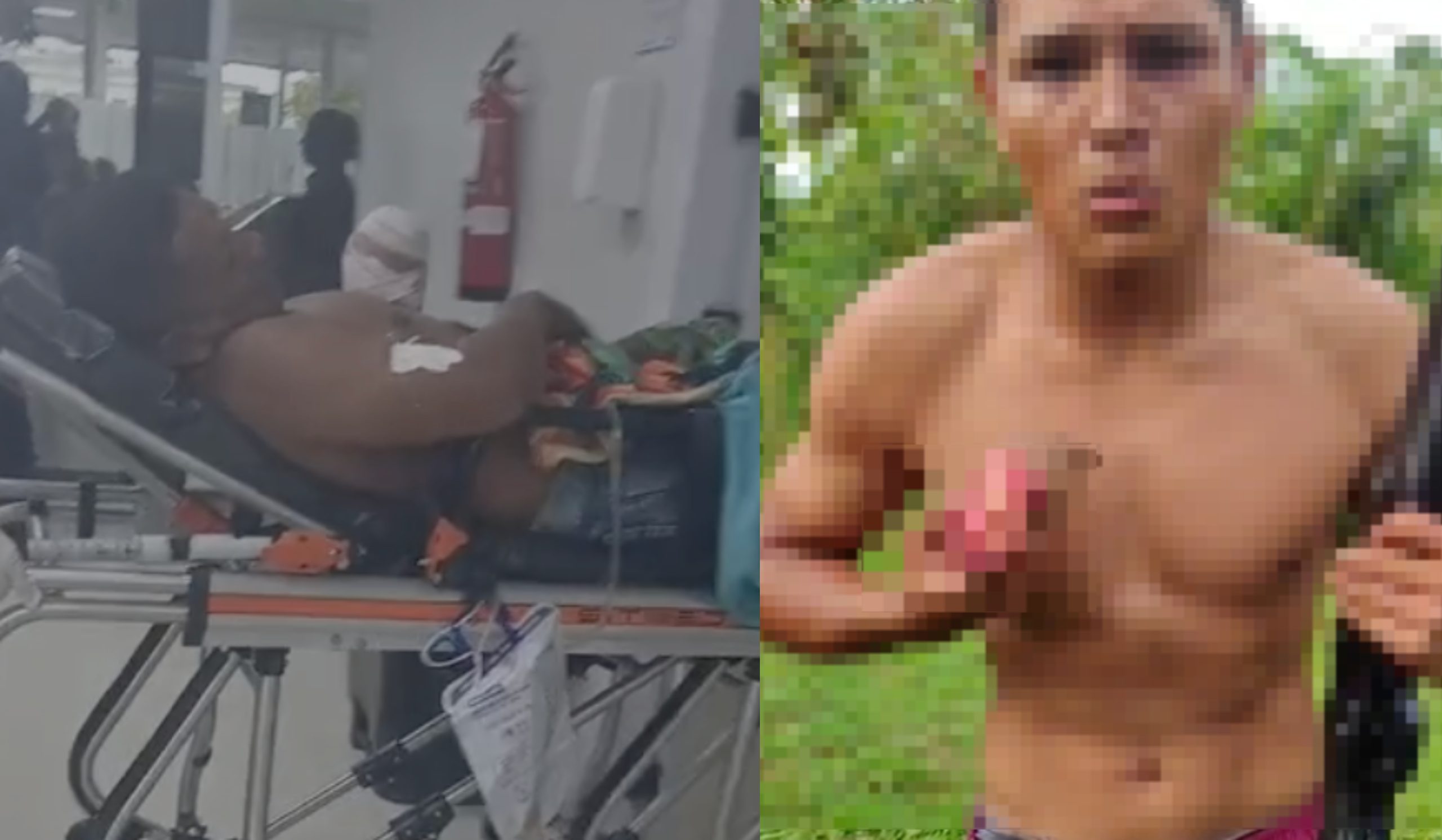 Briga entre vizinhos termina com mão decepada e homem baleado no AM; assista