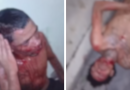 Comunidade cerca suspeitos após roubo de motocicleta e dupla acaba espancada no bairro Aleixo